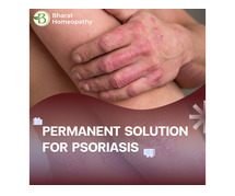 Psoriasis Care Guide Expert Advice for Healthier Skin