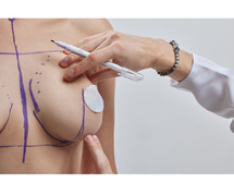 Expert Breast Reduction Surgery in Hyderabad at Ambrosia Clinic