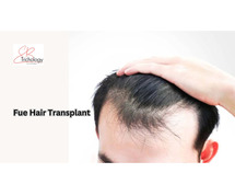 FUE Transplant in Gurgaon at SB Trichology