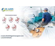 Best Surgeon in Bangalore