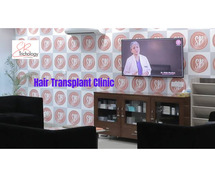 Top Hair Transplant Clinic in Gurgaon | SB Trichology