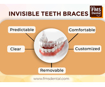 Invisible Braces in Hyderabad, India | Invisible Teeth aligners