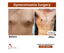 Gynecomastia Surgery & Male Chest Reduction