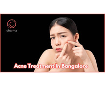 Best Acne Treatment in Bangalore | Charma Clinic