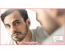 Hair Transplant Cost in Gurgaon | SB Trichology Clinic