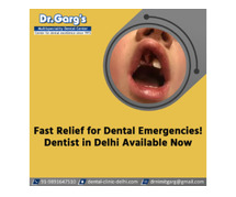 Fast Relief for Dental Emergencies! Dentist in Delhi Available Now