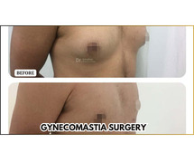 Get Gynecomastia Surgery In Bangalore