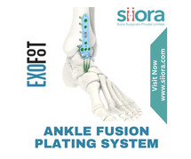 Ankle Fusion Plating System – Stabilizing Ankle Fractures