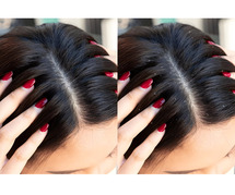 Hair Dandruff Treatment in Chennai