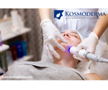 Kosmoderma: Leading Clinic for Laser Acne Scar Treatments and Scar Removal in Bangalore