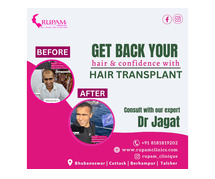 Best Hair Transplant Treatment Clinic in Bhubaneswar for Natural Results