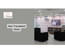 Top Hair Transplant Clinic in Gurgaon