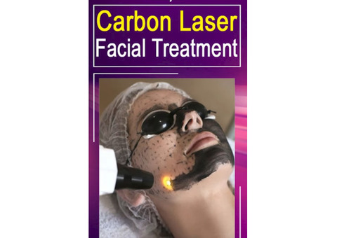 Carbon Laser Facial treatment radiance clinic