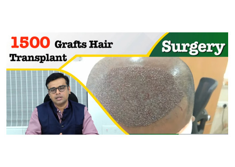 Affordable Hair Transplant in low price  at Radiance Clinic