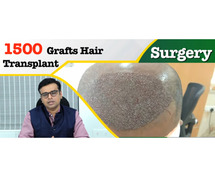 Affordable Hair Transplant in low price  at Radiance Clinic