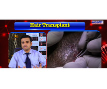 Best Hair Transplant in Bhubaneswar at Radiance Clinic