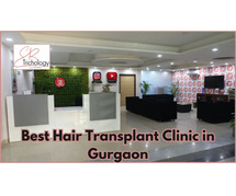 Best Hair Transplant Clinic in Gurgaon