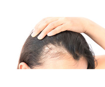 FUE Hair Transplant in Mumbai