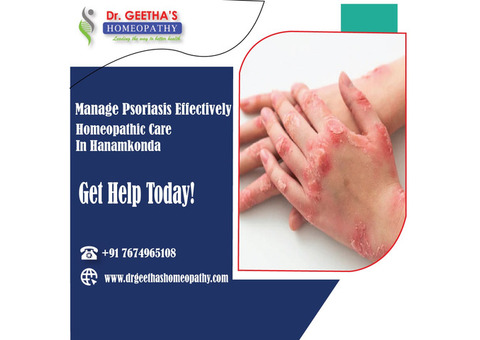 Effective Homeopathy Treatment for Psoriasis in Hanamkonda – Consult Dr. Geetha's Homeopathy