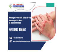 Effective Homeopathy Treatment for Psoriasis in Hanamkonda – Consult Dr. Geetha's Homeopathy