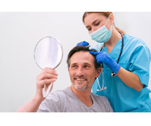 Keralase Hair Restoration Experts in Monterey