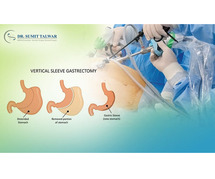 Best Advanced Bariatric Surgeon in Bangalore - Dr. Sumit Talwar