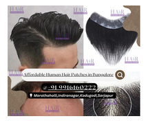 Affordable and Long-Lasting Human Hair Patches in Bangalore