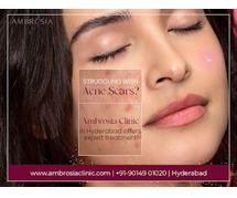 Acne Scar Treatment at Ambrosia Clinic, Banjara Hills, Hyderabad