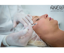 Botox Treatment Cost in Bangalore - Anew Cosmetic Clinic