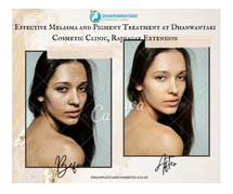 Effective Melasma and Pigment Treatment at Dhanwantari Cosmetic Clinic, Rajnagar Extension