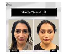 Permanent Non-Surgical Scarless Facelift in India