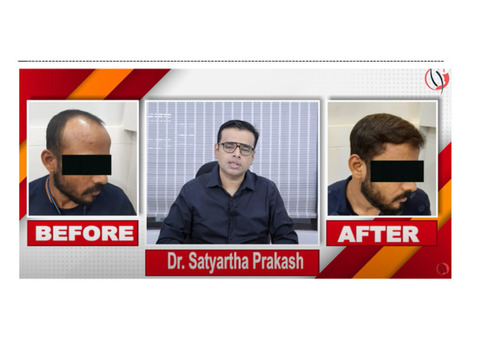 hair transplant success at radiance clinic