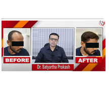 hair transplant success at radiance clinic