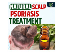 There a Permanent Solution for Psoriasis Exploring Natural and Holistic