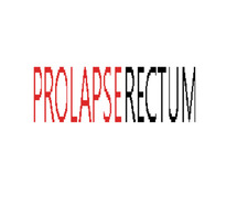 Non Surgical Treatment of Rectal Prolapse