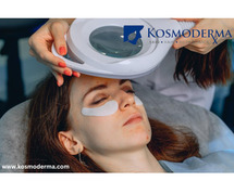 Advanced Laser Treatments for Under Eye Dark Circles and Eye Bags at Kosmoderma in Delhi