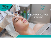 Best Hydrafacial in Bangalore - Anew Cosmetic Clinic