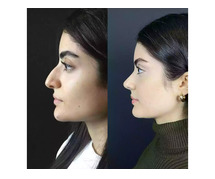 Best Nose Job in Abu Dhabi