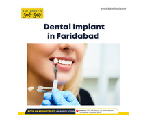 Best Dental Implant in Faridabad