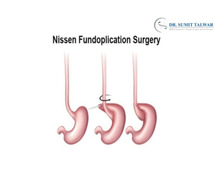 Best Fundoplication Surgery in Bangalore - Dr. Sumit Talwar