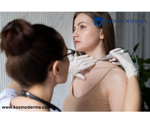 Expert Skin Tag Removal Clinic in Bangalore