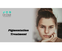 Pigmentation Treatment In Bangalore