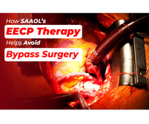 How SAAOL EECP Treatment Heaps Avoid Bypass Therapy