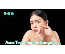 Acne treatment in Bangalore