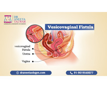 Best Vesico-Vaginal Fistula Surgeon in Whitefield - Dr. Aneeta Talwar