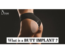 Get A Butt Implant At Divine Cosmetic Surgery