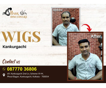 Looking For Best Hair Patch and Hair Wigs Center in Kankurgachi, Kolkata Visit Hair Disclosure