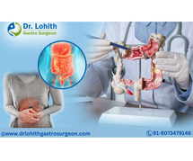 Best Gastroenterologist in Bangalore - Dr. Lohith U