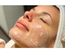 Chemical Peel Treatment In Delhi