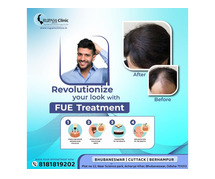 Top Hair Transplant Treatment Clinic for Natural-Looking